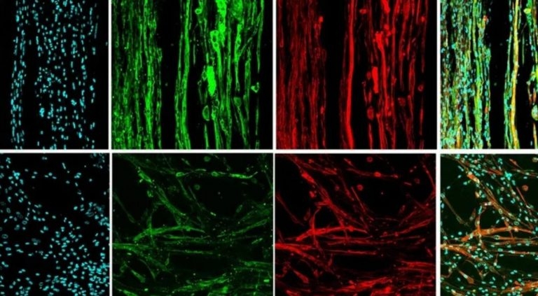 Мышечную ткань впервые напечатали без гравитации: почему это прорыв Мышечную ткань впервые напечатали без гравитации: почему это прорыв