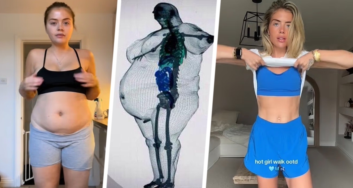 Женщина смогла похудеть на 23 кг после двух кесаревых сечений, чтобы выглядеть привлекательно на пляже в отпуске