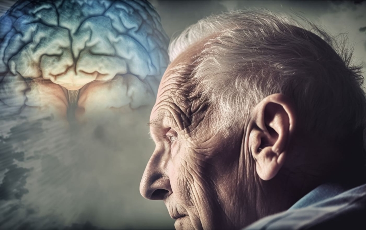 Найдена связь между незаметными повреждениями мозга и риском деменции