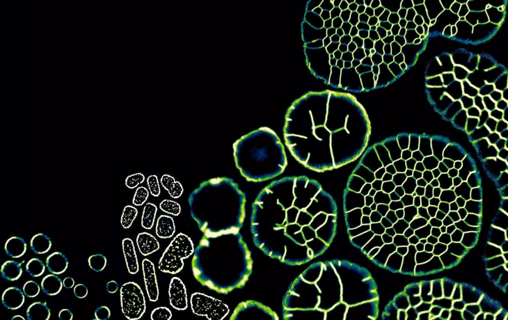 Древние одноклеточные сформировали сложную &laquo;ткань&raquo; под давлением