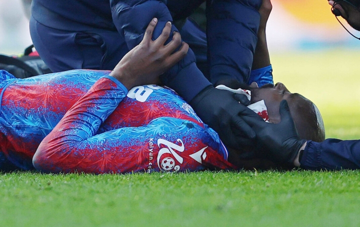 Футболисту &laquo;Кристал Пэлас&raquo; наложили 25 швов на ухо и выписали из больницы