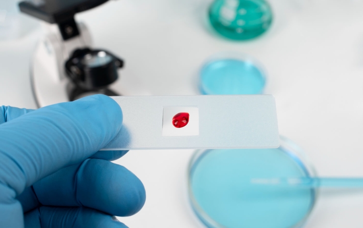 ИИ диагностирует диабет, ВИЧ и COVID по одному образцу крови ИИ диагностирует диабет, ВИЧ и COVID по одному образцу крови