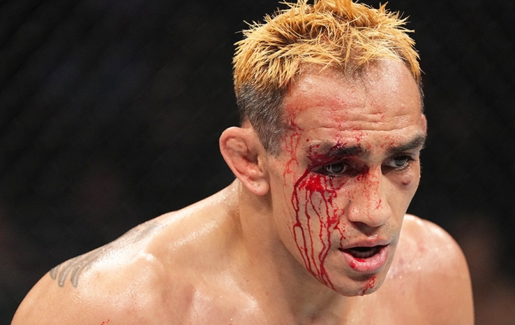 Тони Фергюсон подписал контракт с Global Fight League Тони Фергюсон подписал контракт с Global Fight League