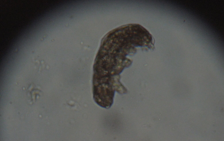 «Суперсилу» тихоходок использовали для защиты здоровых клеток от лучевой терапии «Суперсилу» тихоходок использовали для защиты здоровых клеток от лучевой терапии