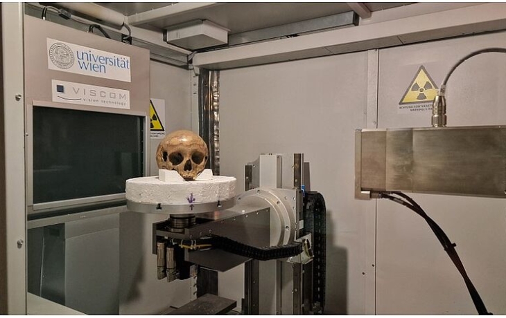 &laquo;Сестра Клеопатры&raquo; оказалась римским больным подростком