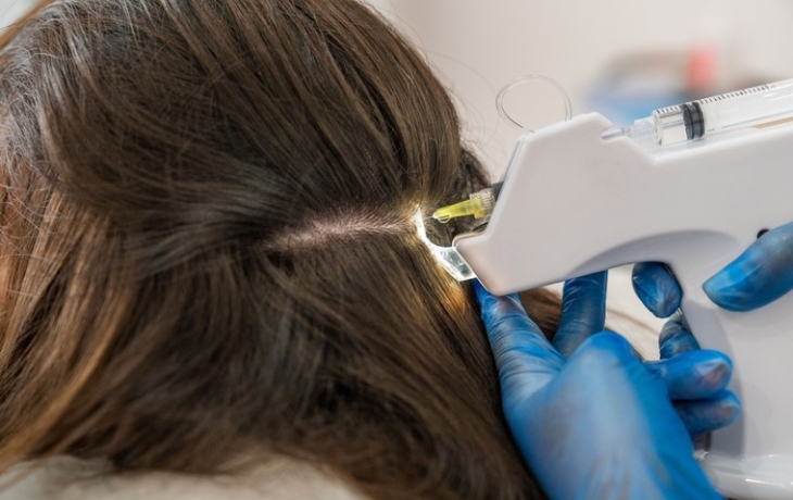 Поход в салон обернулся для россиянки облысением и заражением крови Поход в салон обернулся для россиянки облысением и заражением крови