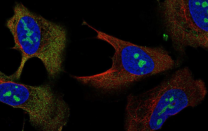 Интерактивная карта клетки человека раскрывает тайны детского рака костей Интерактивная карта клетки человека раскрывает тайны детского рака костей