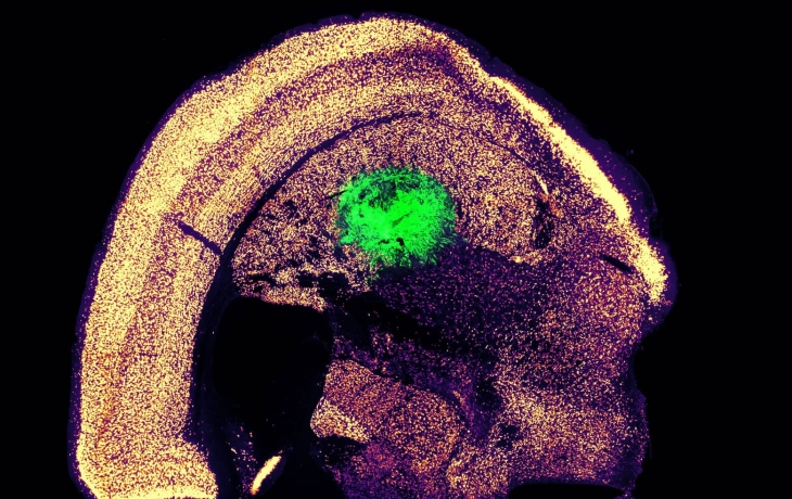Ученые MIT разработали &laquo;простой способ&raquo; превратить клетки кожи в нейроны